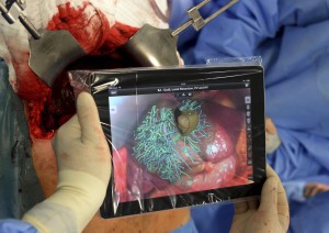 iPad w Medycynie - operacja wątroby
